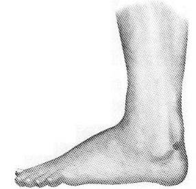 脚踝的部位可以用胶带直接将磁铁贴在皮肤上