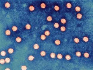 ：溶液中悬浮的人乳头瘤病毒（HPV）