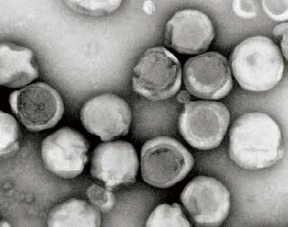 ：能够感染海洋中藻类的赫氏圆石藻病毒