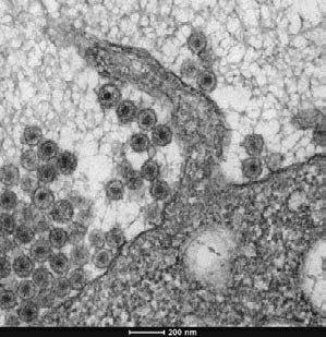：禽白血病病毒从人类白细胞释放出来