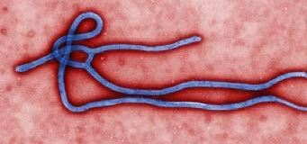 ：电子显微镜下的埃博拉病毒