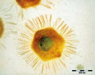 ：拟菌病毒，已知体积最大的病毒