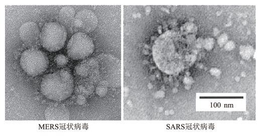MERS,SARS冠状病毒