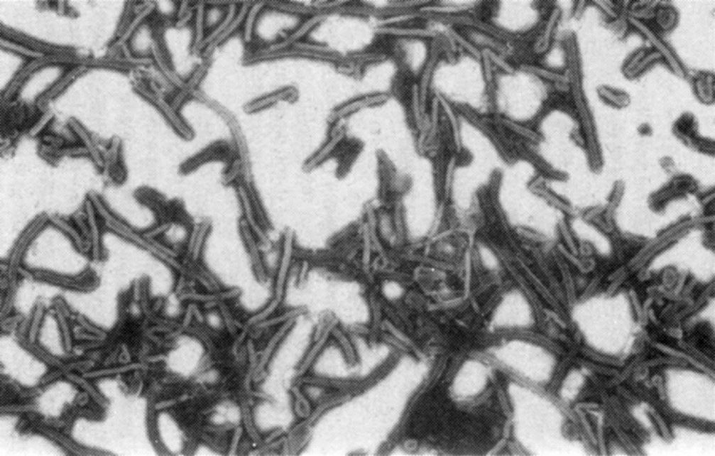 扎伊尔埃博拉病毒粒子，放大17000倍。请注意一些粒子顶端的圈环，也就是所谓“牧羊人的曲杖”或“有眼螺栓”，这是扎伊尔埃博拉病毒及其姐妹的典型形态。拍摄者：托马斯·W·盖斯伯特，USAMRIID。