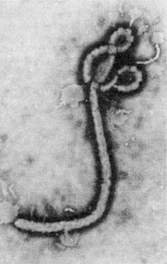 埃博拉病毒粒子