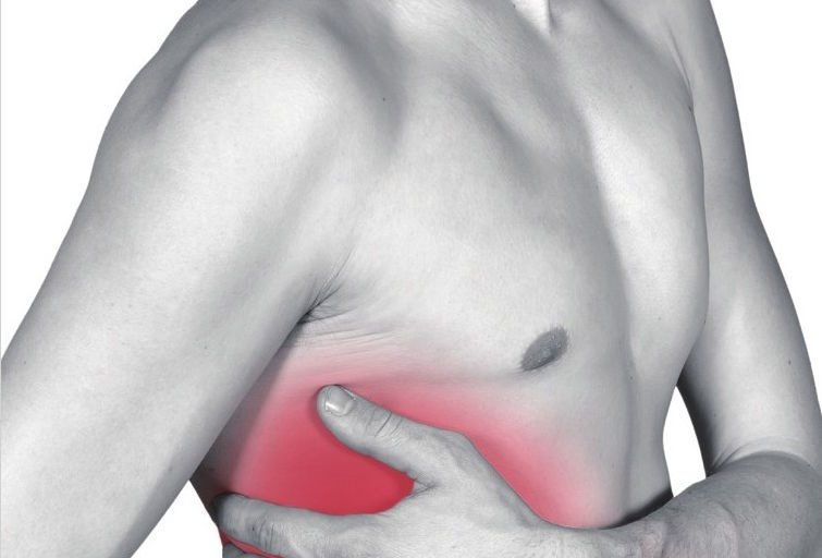肋痛一般是由3种情况引起的