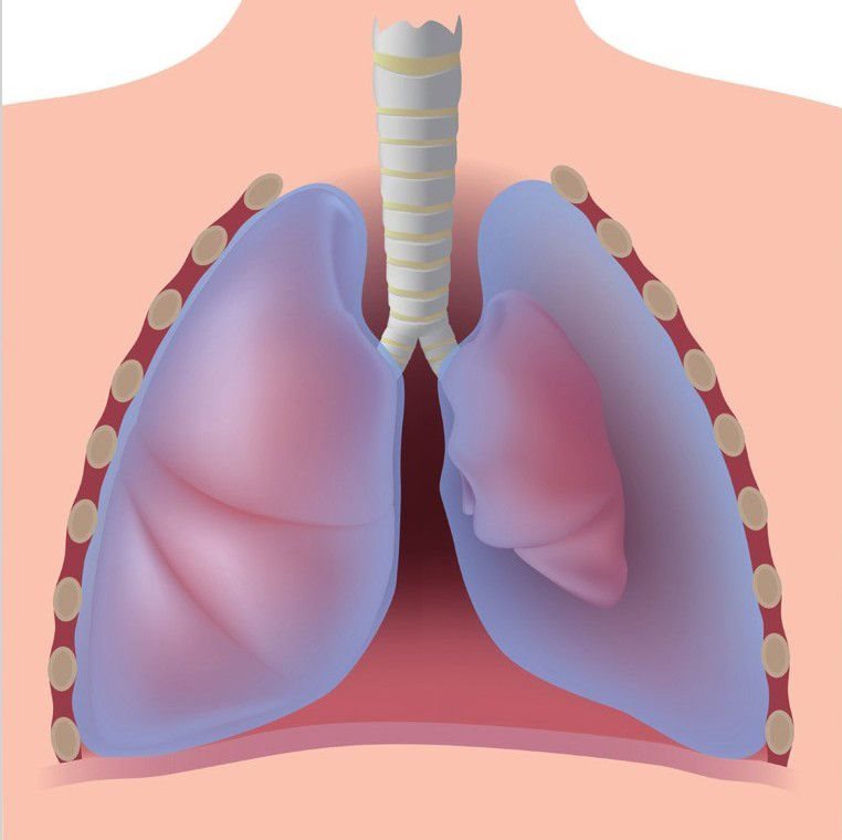 气胸示意图气胸是发病率很高的肺部疾病之一