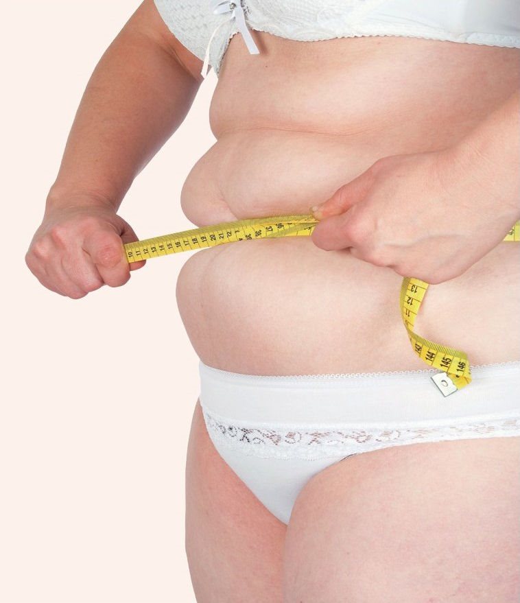 向心性肥胖是肾上腺皮质醇增多症的症状之一