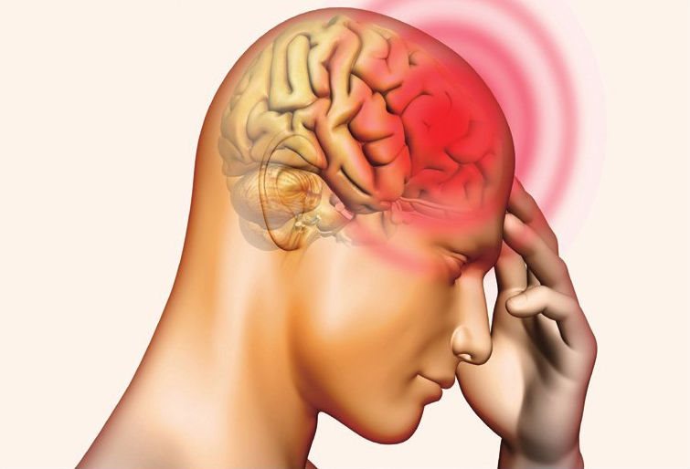 头痛是日常生活中最普遍的疼痛之一，根据引起头痛的原因可以分为神经性头痛、颅内病变引起的头痛、颅外病变引起的头痛等几类