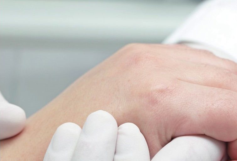 类风湿性关节炎一般是指关节、腕关节等小关节受到感染,但如果症状严重,需要立即就医治疗