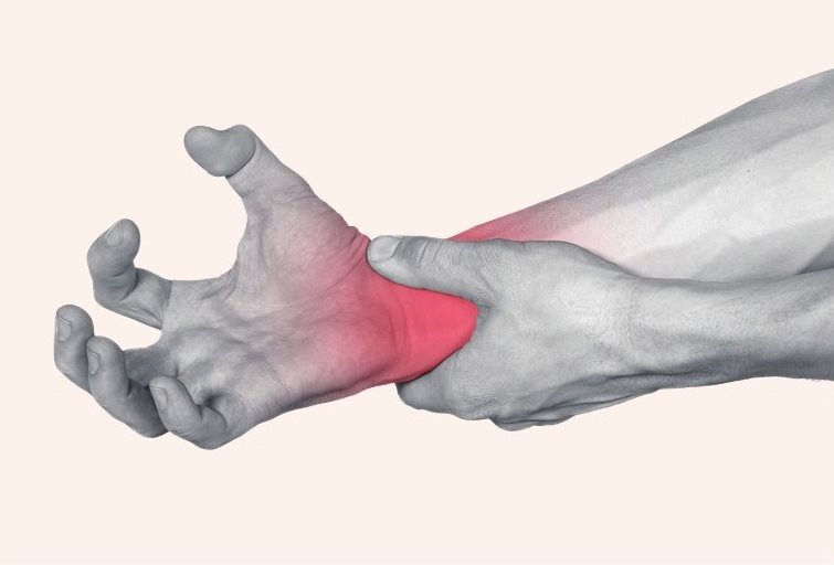 手腕疼痛是由于使用过度引起的肌腱发炎、肿胀，从而出现刺痛
