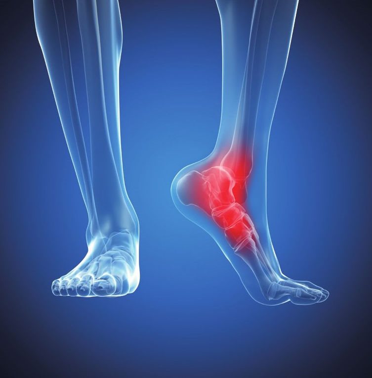 脚踝疼痛一般是外伤、关节脱臼或关节炎、静脉曲张等导致的