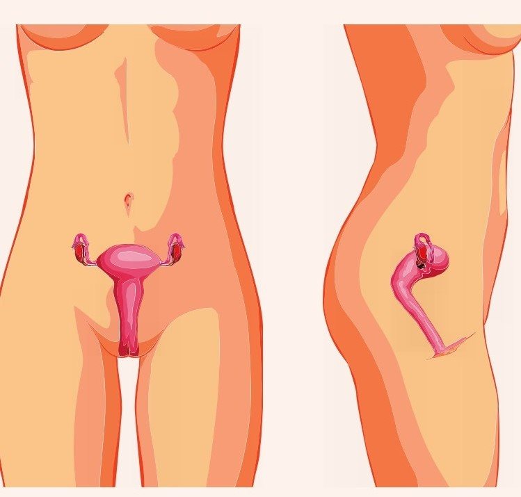女性比男性更容易发生尿路感染，因为女性的尿道口临近阴道口，而阴道口又是肠道菌滋生的地方