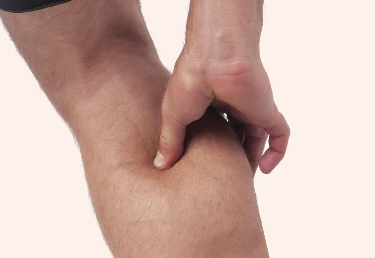 肌肉拉伤是一种常见的肌肉损伤，一般触痛明显，并可以看到患部出现肿胀