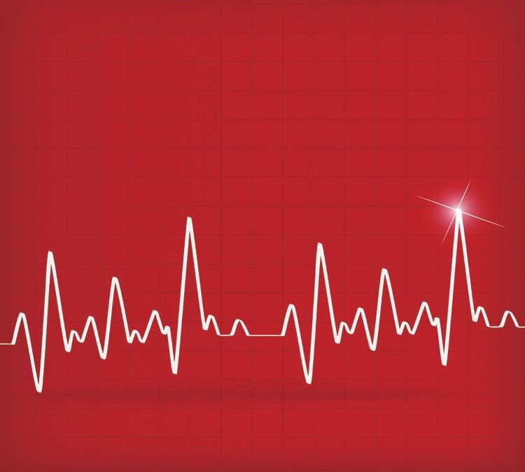 此为心悸时心脏的搏动图，如果是在剧烈运动之后发生，可能属于正常现象，但是连续数天之内反复发作，则要及时就医