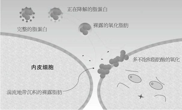 动脉硬化的诊断方法：勃起功能障碍与内皮功能异常