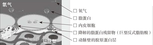 快餐导致先天畸形