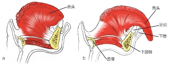 a舌头 舌头牙齿下唇下颌骨b 舌骨