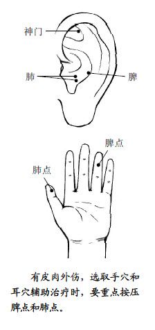 2.不吃药，您就可以减轻伤口的疼痛