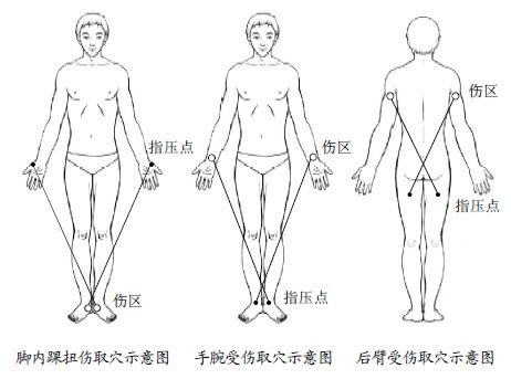 3.筋骨扭伤后照着X形就能找到好药