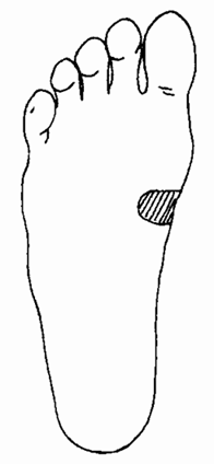 胃部不适的治疗