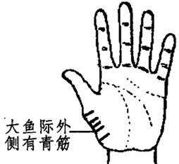 大鱼际外侧有青筋 大鱼际外侧有青筋