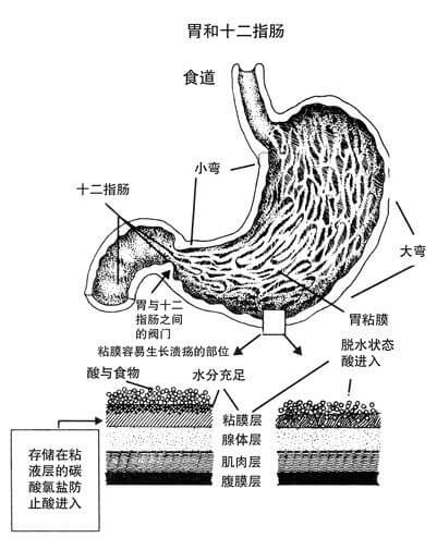 第三章 消化不良引起的疼痛
