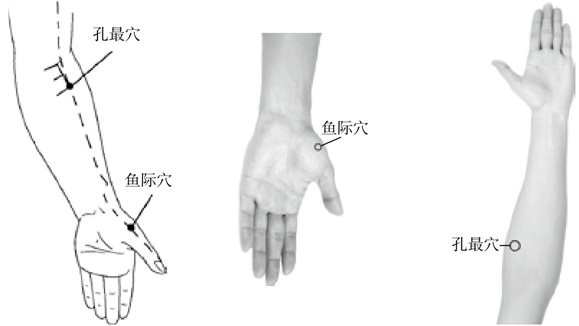 按时间规律发作的病症，自我调经络手到病除