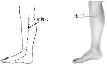 按时间规律发作的病症，自我调经络手到病除
