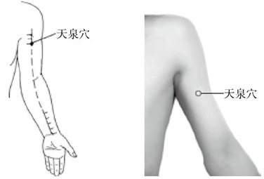 按时间规律发作的病症，自我调经络手到病除