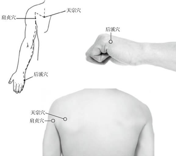 小肠经体检——探寻、清除小肠经隐患