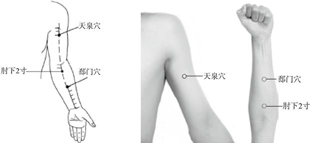心包经体检——探寻、清除心包经隐患