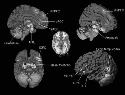  情绪脑机制的元分析结果（来源