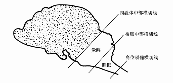 第五节 睡眠与觉醒的脑机制