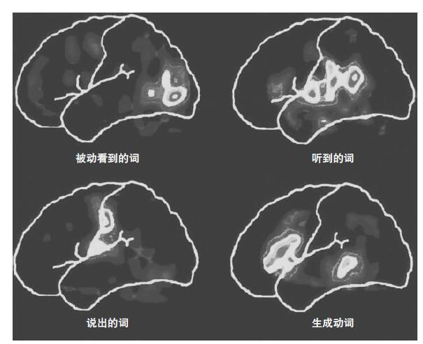 一个fMRI扫描的例子，其中大脑扫描中高亮的颜色说明更强的新陈代谢活动
