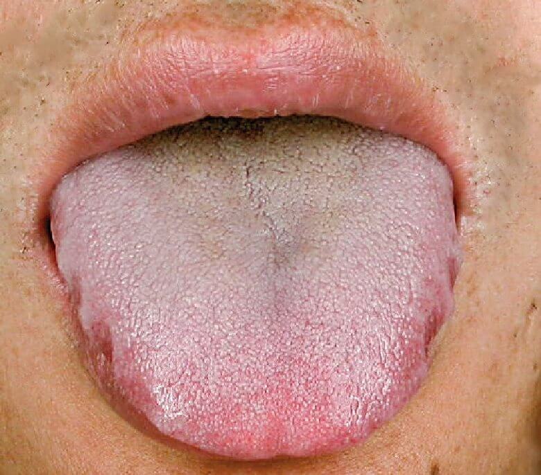 第四章 人活一口气：气虚体质的人如何保养