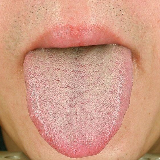 第四章 人活一口气：气虚体质的人如何保养