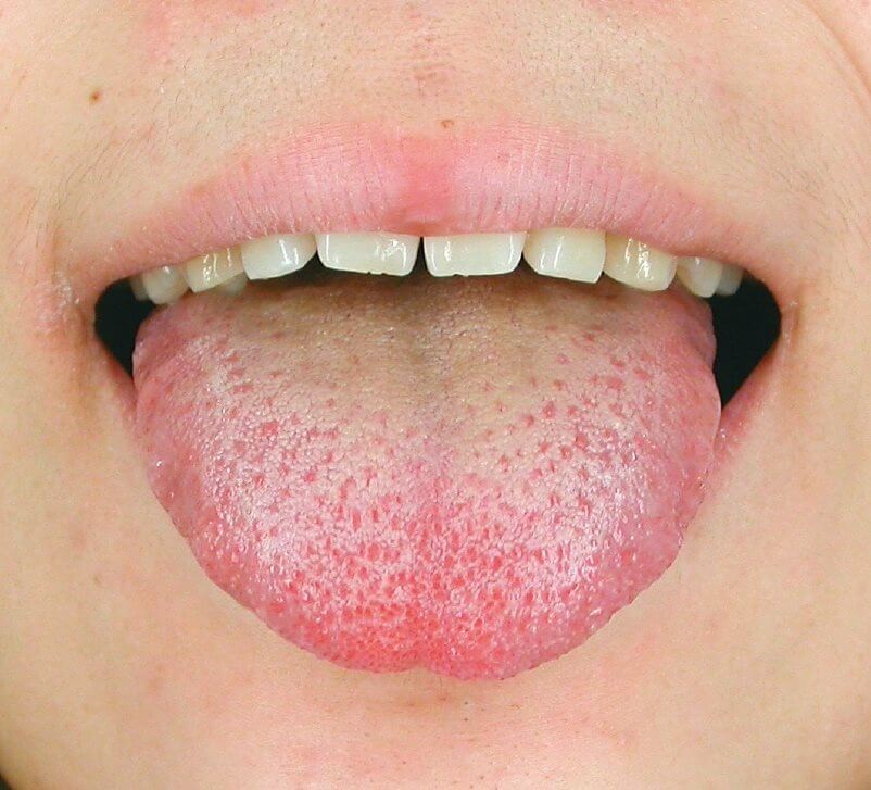 第四章 人活一口气：气虚体质的人如何保养