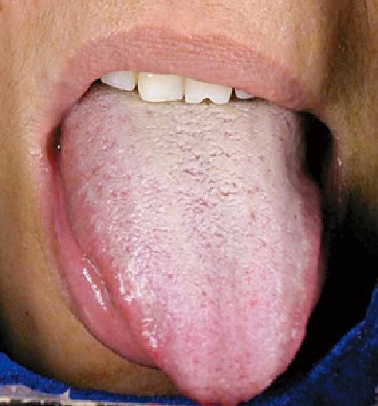第六章 血瘀生百病:瘀血体质的人如何保养