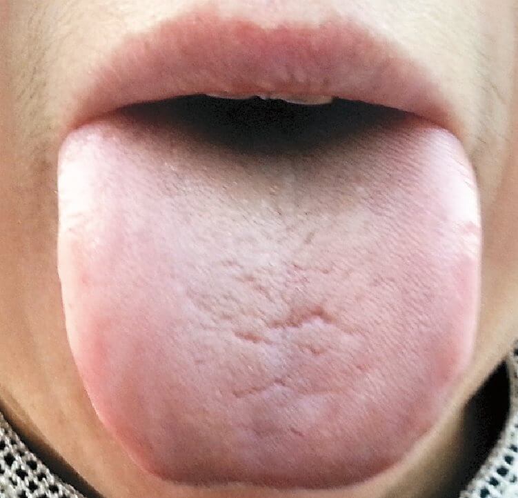 第八章 做人就要阳气十足:阳虚体质的人如何保养