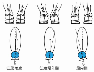 第三章 你的跑姿正确吗?