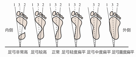 第二章 如何自己评估损伤风险?