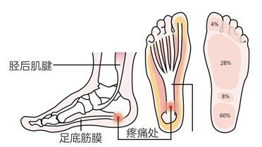 第二十五章 其他跑步损伤