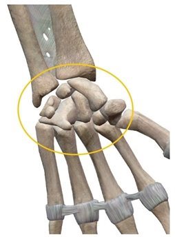 关节都是什么样的