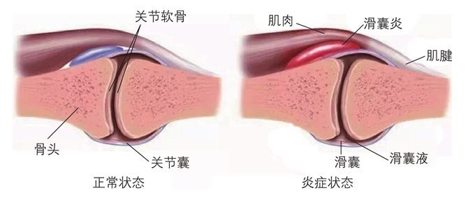 关节都是什么样的