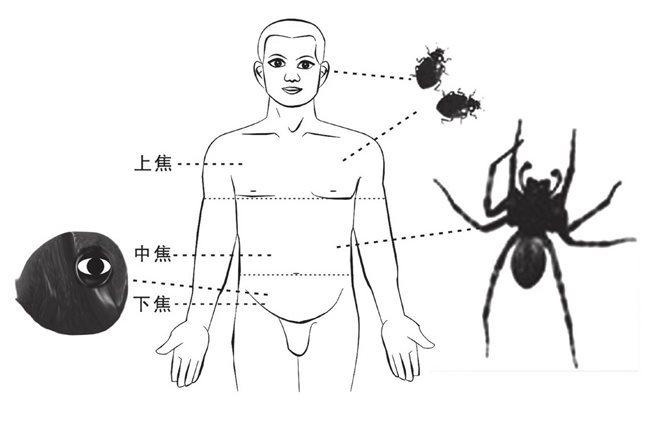 三虫在人体示意图