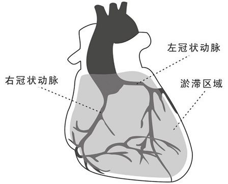 心藏冠状动脉的瘀带
