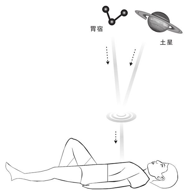 胃宿和土星下照溃疡图