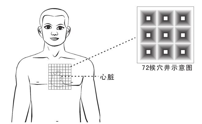 心藏72穴开