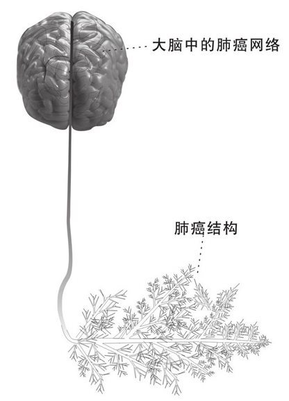 大脑中的肺癌网络和空体中的肺癌结构